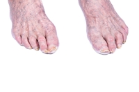 Pedicures and the Elderly Population