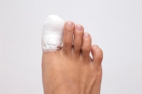 Possible Treatment of a Broken Toe
