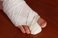 How to Deal With Toe Fractures