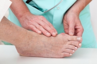 Is There A Reduction of Bunions in Non-Western Countries?
