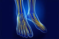Tarsal Tunnel Syndrome and Nerve Damage